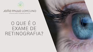 O que é o exame de retinografia  Dr João Paulo Lomelino [upl. by Nyrmak249]