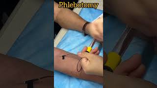 Laboratory tests  phlebotomy music viralshorts medicaleducation trending [upl. by Ameyn695]