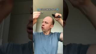 CUTE HAIRSTYLE 😍 ALERT ‼️ hair hairstyle funny youtubeshorts shorts bald [upl. by Magnien619]