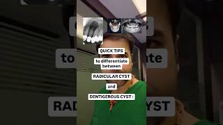 Radicular cyst VS Dentigerous Cyst dentistry dentistrytips dentaltips dentalstudent dental [upl. by Luhey]