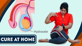 इन योग से ठीक होगा हाइड्रोसील घर बैठे  Best YOGA POSES to CURE Hydrocele at Home FAST  Yogawale [upl. by Drahsir]