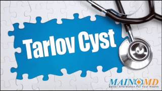 Tarlov Cyst ¦ Treatment and Symptoms [upl. by Eillom891]