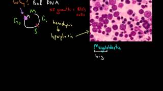 Macrocytic Anemia [upl. by Attaynek]