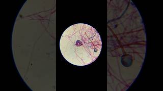 Rhizopus under the microscope [upl. by Htnnek]