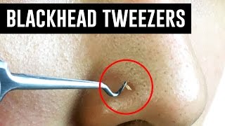 Tweezers That Remove Blackheads TINA TRIES IT [upl. by Nefets]