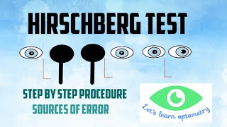 Hirschberg corneal reflex test [upl. by Ayom580]