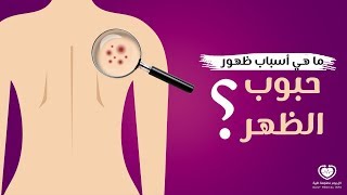 أسباب ظهور حبوب الظهر وطرق التخلص منها [upl. by Eimyaj775]