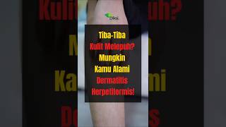 TibaTiba Kulit Melepuh Kamu Alami Dermatitis Herpetiformis youtubeshorts infotentangkesehatan [upl. by Aleak110]