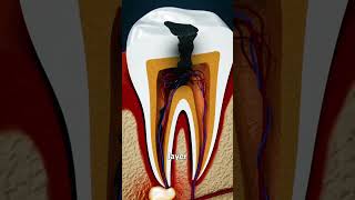 Why Grinding Your Teeth Is Bad 😱 [upl. by Trilly]