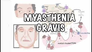 Myasthenia gravis History mrcpch Clinical [upl. by Rodmur]