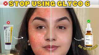 Is Glycolic Acid Right For You SAFE Alternatives to Try Instead [upl. by Akener77]