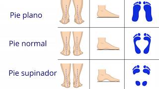 Fisioterapia y Osteopatía para la fascitis plantar [upl. by Otsirc360]