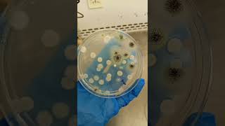 Fungus on Potato Dextrose agar [upl. by Scotti440]