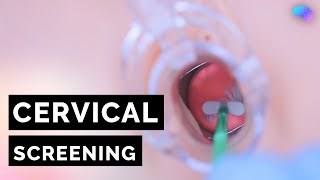 Cervical Screening Smear  HPV  OSCE Guide  UKMLA  CPSA [upl. by Amoeji109]