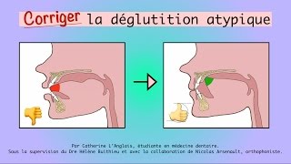 Corriger la déglutition atypique [upl. by Watt417]