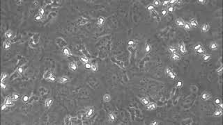 Neutrophil migration on endothelial cell lawn on SiMPore membrane [upl. by Leahcar799]