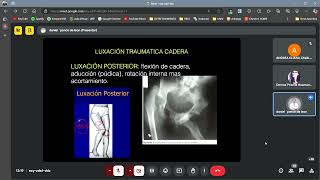 Semiología MIEMBRO INFERIOR  cadera rodilla tobillo meniscos ligamento cruzado  TRAUMATOLOGÍA [upl. by Blanding]