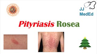 Introduction to Pityriasis Rosea  Possible Causes Symptoms and Treatment [upl. by Torrin]