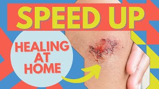 Wound Care How To Heal Faster At Home [upl. by Jarrow668]