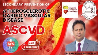 Secondary Prevention of Atherosclerotic Cardio Vascular Disease by Sanjeewa Rajapakse [upl. by Cati986]