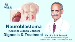 Neuroblastoma  Diagnosis amp Treatment  Dr SVSS Prasad Medical Oncologist  Apollo Hospital [upl. by Trocki]