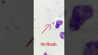 Amastigotes de Leishmania en lámina con tinción Giemsa leishmania microbiología uta [upl. by Yennor]