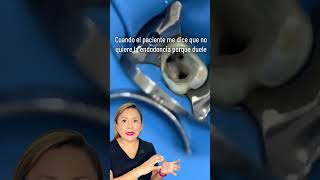 La endodoncia puede ser la solución para salvar tu diente y aliviar el dolor [upl. by Akerdnahs846]