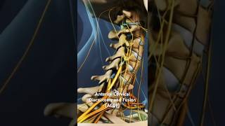 Anterior Cervical Discectomy and Fusion ACDF [upl. by Ahidam419]