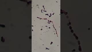 Streptococcus agalactiae in Gram staining of Culture Microscopy [upl. by Jacob]