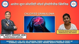 Calcified Granuloma Patient Treated By Dr Arpit Chopra Jain [upl. by Bilak374]