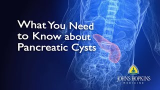 What You Need to Know About Pancreatic Cysts [upl. by Ellehcin]