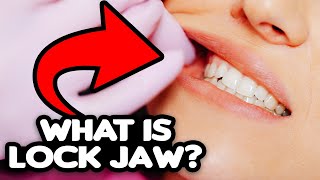 Lock Jaw Explained causes treatment prevention [upl. by Guevara]