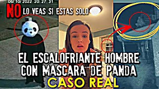 El escalofriante video del hombre panda  Caso Real [upl. by Dnarb80]