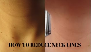 Benefits of Petroleum Jelly for Neck wrinklesBeautywdbrain [upl. by Ingrim274]