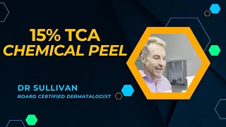 15 TCA Chemical Peel for Acne and Pigmentation acne chemicalpeels brownspots hyperpigmentation [upl. by Walcoff10]