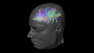 REAL Brain Nerves Tractography [upl. by Conni]