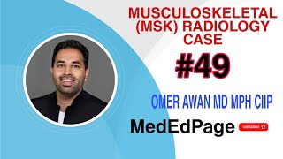 Musculoskeletal MSK Radiology CASE 49 [upl. by Namzaj]