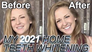 I Tested The Best Home Teeth Whitening Kit iSmile California [upl. by Gauldin799]