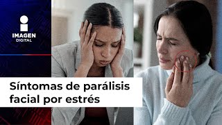 Dolor de mandíbula y otros síntomas te revelan que podrías tener parálisis facial por estrés [upl. by Eltsyek]