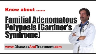 Familial Adenomatous Polyposis Gardners Syndrome  Causes Diagnosis Symptoms Treatment [upl. by Eenert]