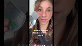 Hairdresser shares horrific LICE INFESTATION on girls head Part One [upl. by Eixirt]