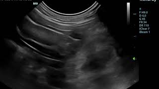 Small Animal Ultrasound  Foreign Body obstructing the Small intestine [upl. by Aniela]