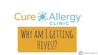 Why am I getting Hives  Allergist explains different causes [upl. by Aieken505]