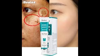 Whitening Freckle Cream Remove Melasma Dark Spot – iBeaLee™ [upl. by Fermin]