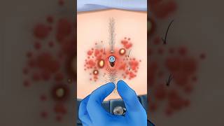 Balle button clean Asmr remove navel ston animation [upl. by Ayanal]