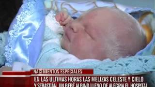 Junio un mes de nacimientos especiales nacieron mellizas y un bebé albino en el hospital San Roque [upl. by Uranie]