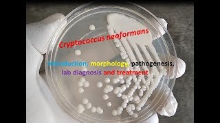 Cryptococcus neoformans Introduction morphology pathogenesis lab diagnosis and treatment [upl. by Ev]