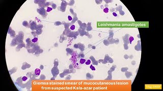 Leishmania amastigotes Microscopy [upl. by Atsejam]