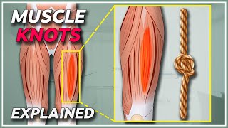 What is a muscle knot  Muscle knots amp trigger points explained [upl. by Egiaf]