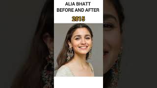 Alia Bhatt Evolution Alia Bhatt biographybollywood aliabhatt biography ytshorts shorts [upl. by Madda]